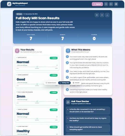 Simple MSR explanation